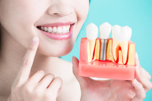 Do You Need an Oral Implant Facility?